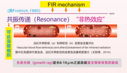 红外线内裤的作用