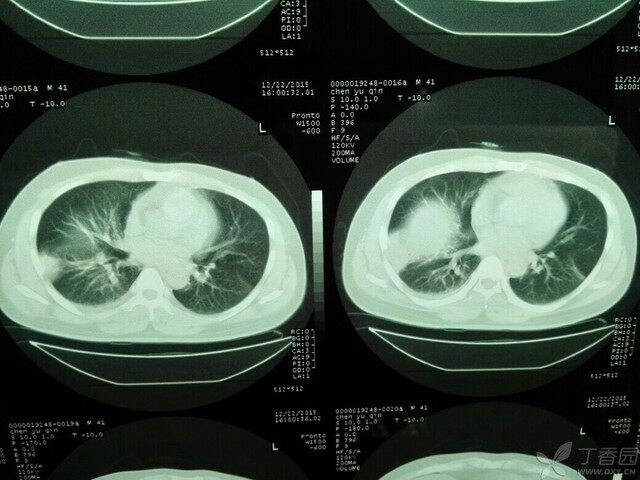 化纤类混纺与卤素灯厂家联系